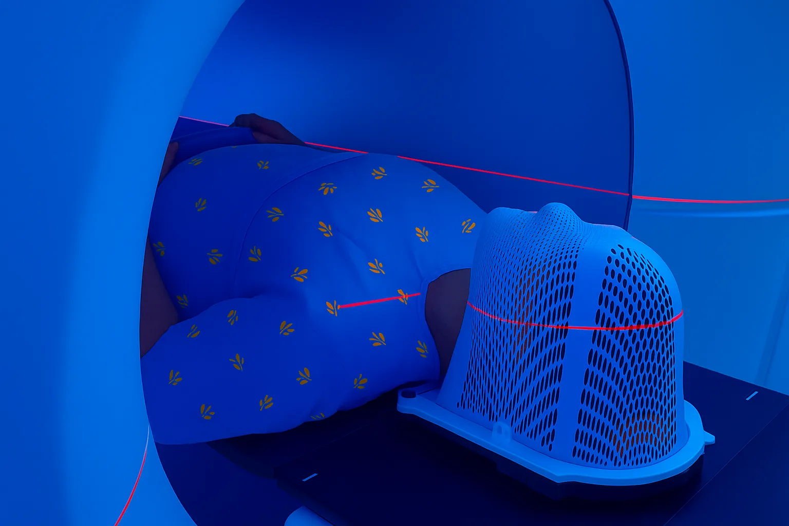 Preparing for radiation therapy
