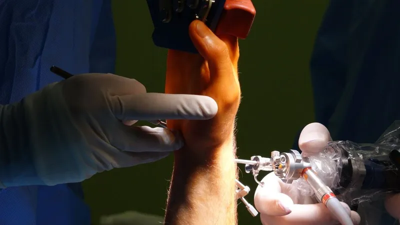 Orthopaedic Joint Replacement in Mumbai for Patients from Mauritius: A Complete Guide