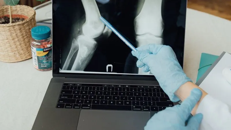 Knee Replacement in Mumbai for Patients from Oman: When to Consider Surgery