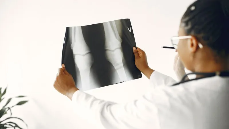 Joint Replacement in India for Russian Patients: Questions to Ask Before Travelling