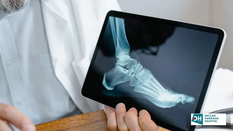 Ankle Ligament Injury: Grades, Diagnosis, and When Arthroscopy Is Required