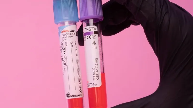 Anaemia: Types, Causes, and When It Signals a Blood Disorder