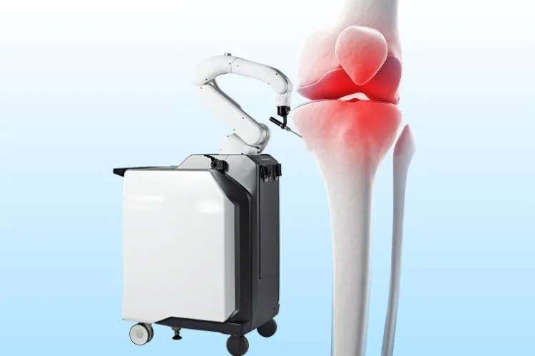 Is Robotic Joint Replacement Right for You? A Complete Guide