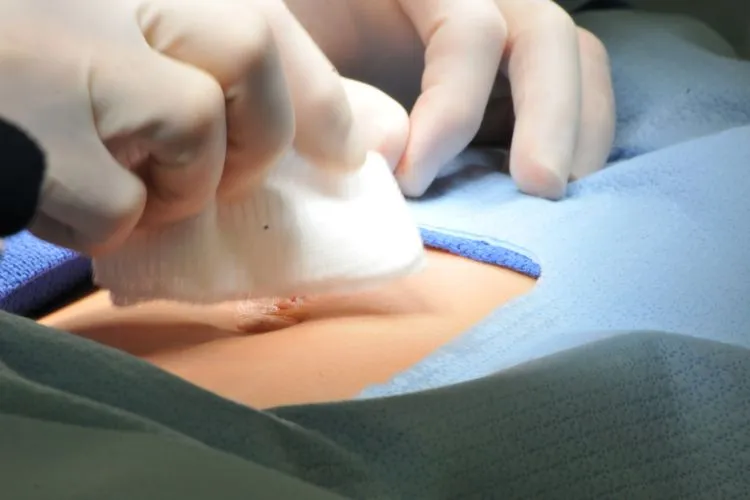 Benefits of Minimally Invasive Hernia Surgery at Deccan Hardikar Hospital