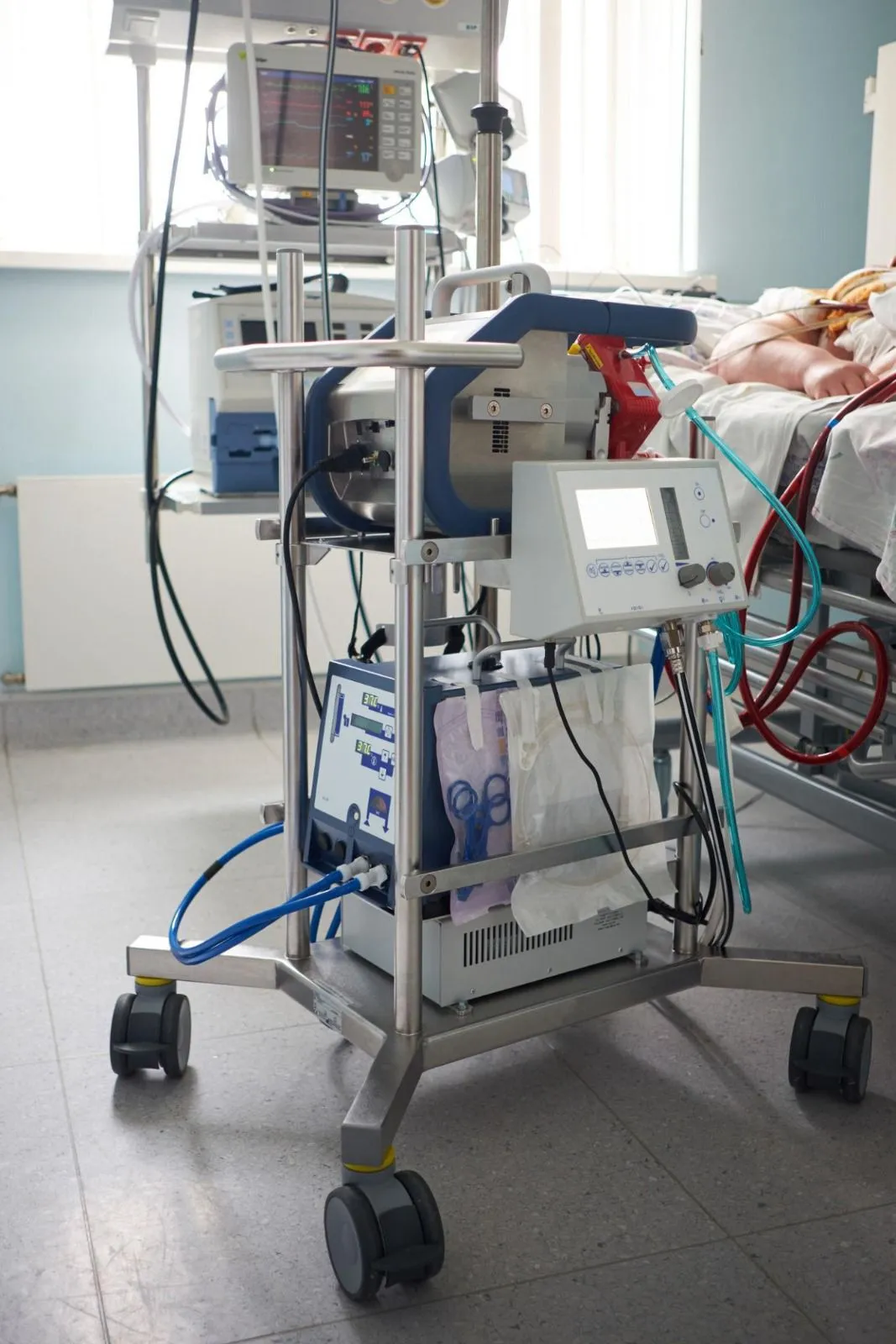 Conditions We Treat with ECMO