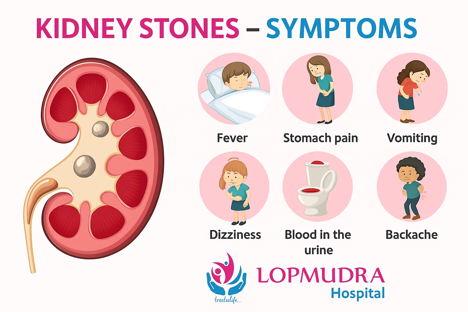 Kidney Stone Symptoms - Pune