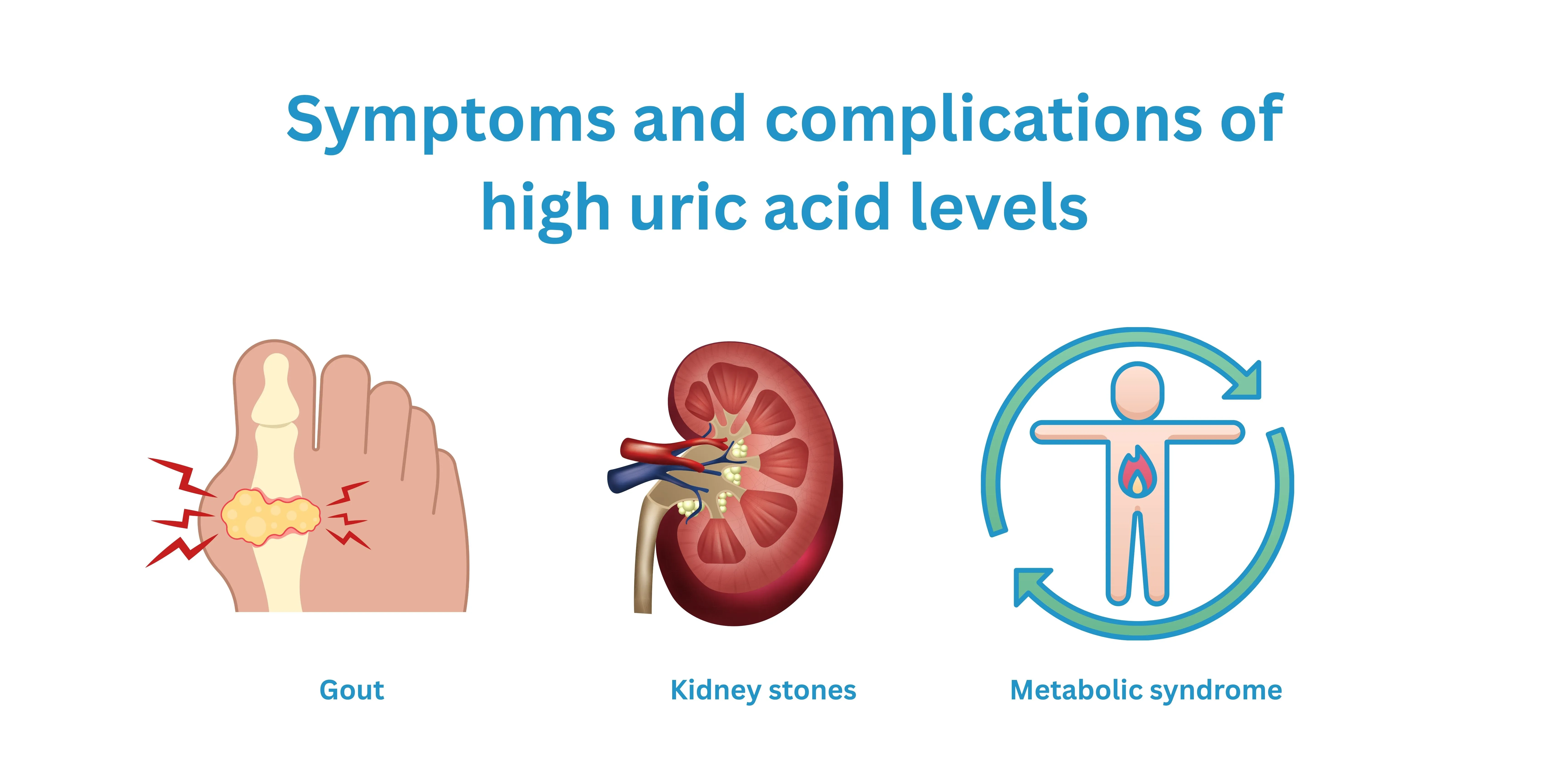 Symptoms and complications of high uric acid levels