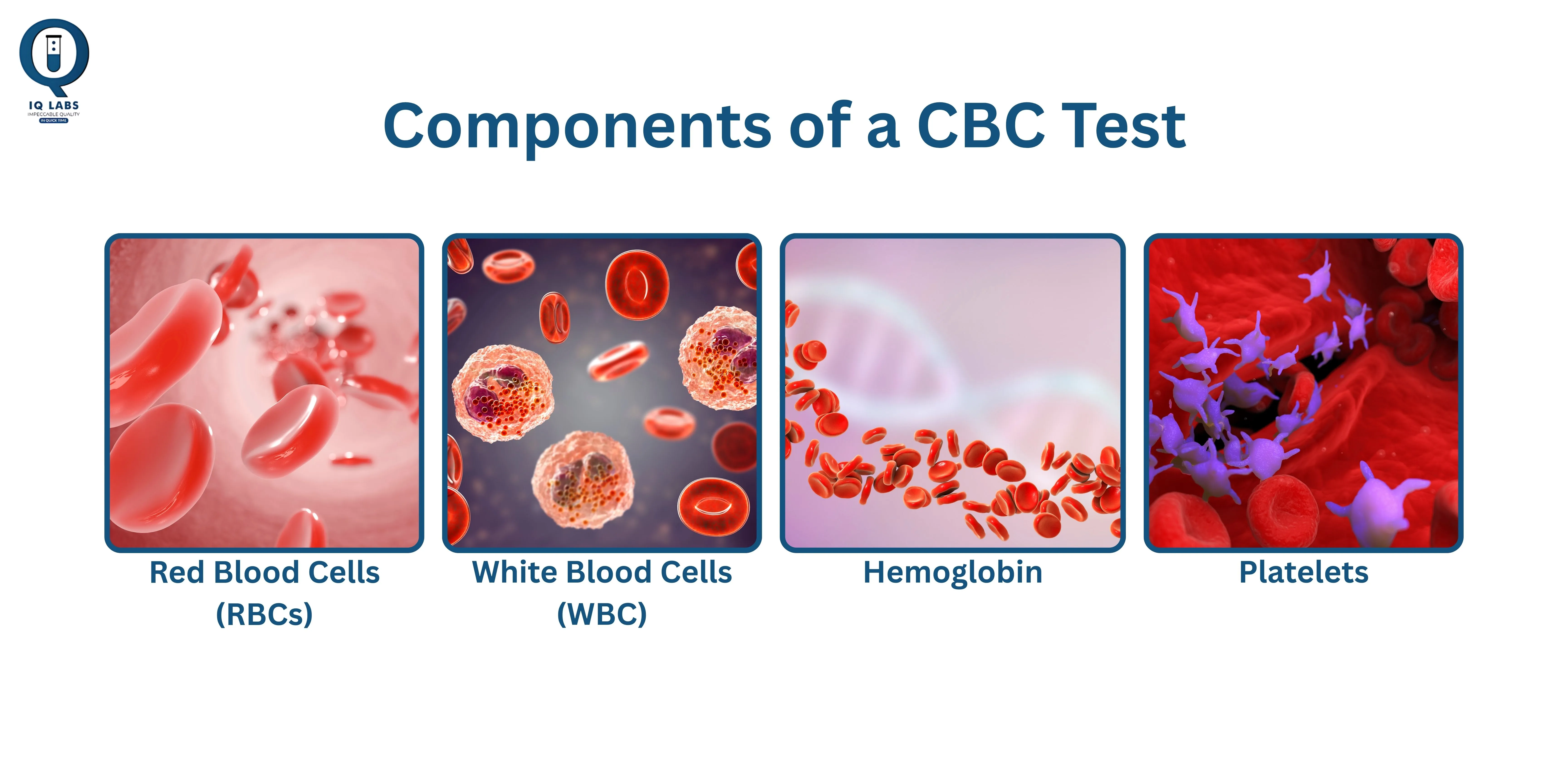 Complete Blood Count Procedure at IQ Labs Diagnostics