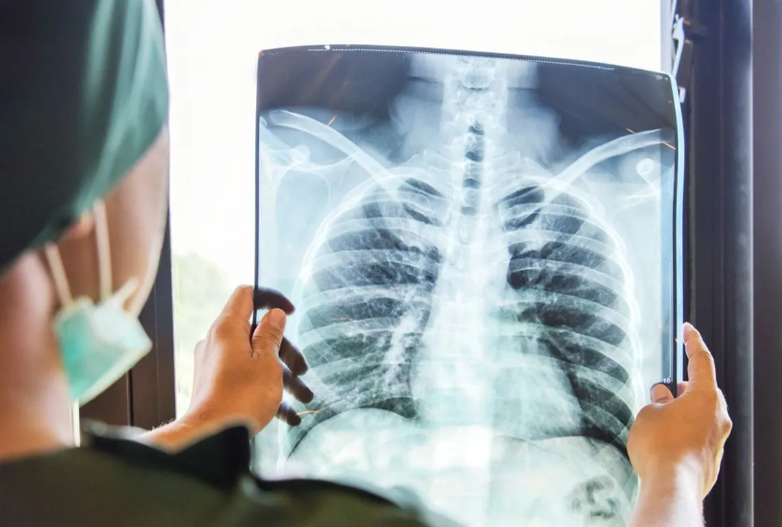 Pulmonary Medicine