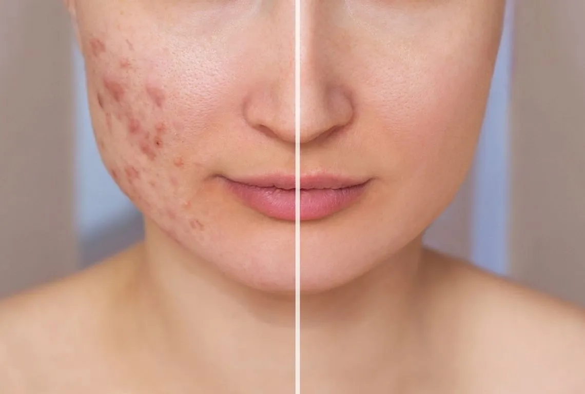 Dermatology Care