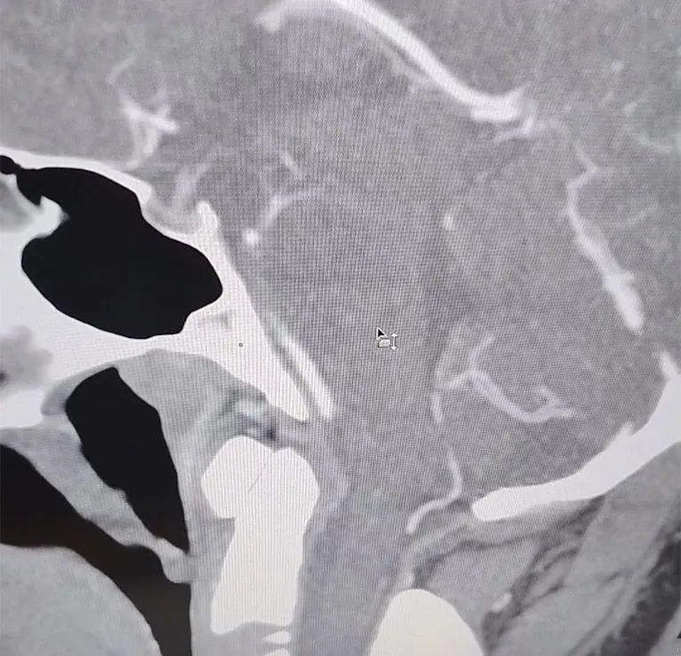 CT-Angiogram.jpg
