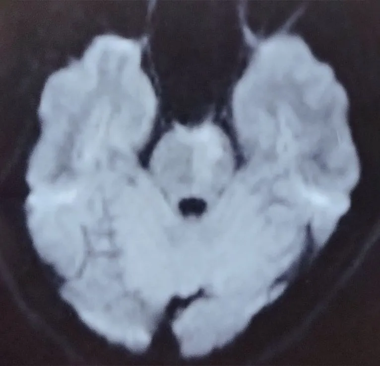 MRI-Brain.jpg