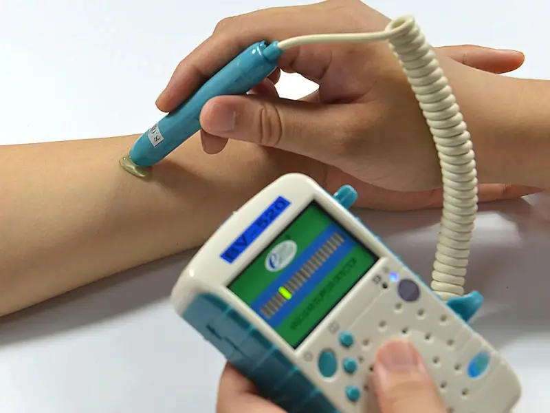 Vascular Doppler Carotid Doppler