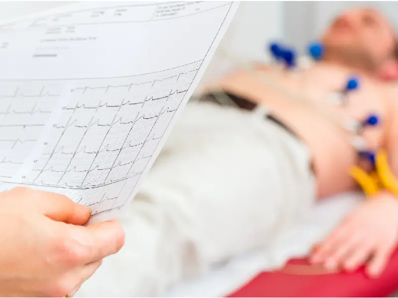 Dobutamine Stress Echo DSE