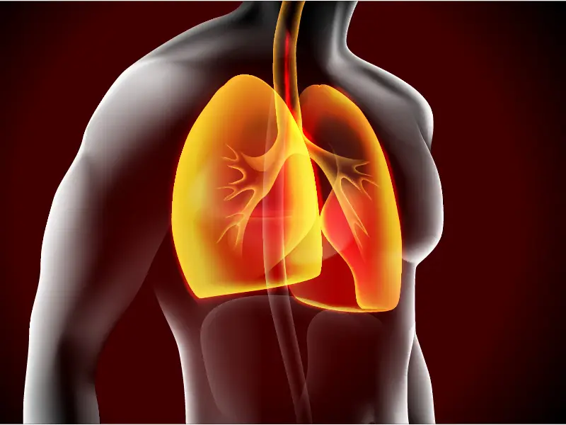 Thoracic Surgeries