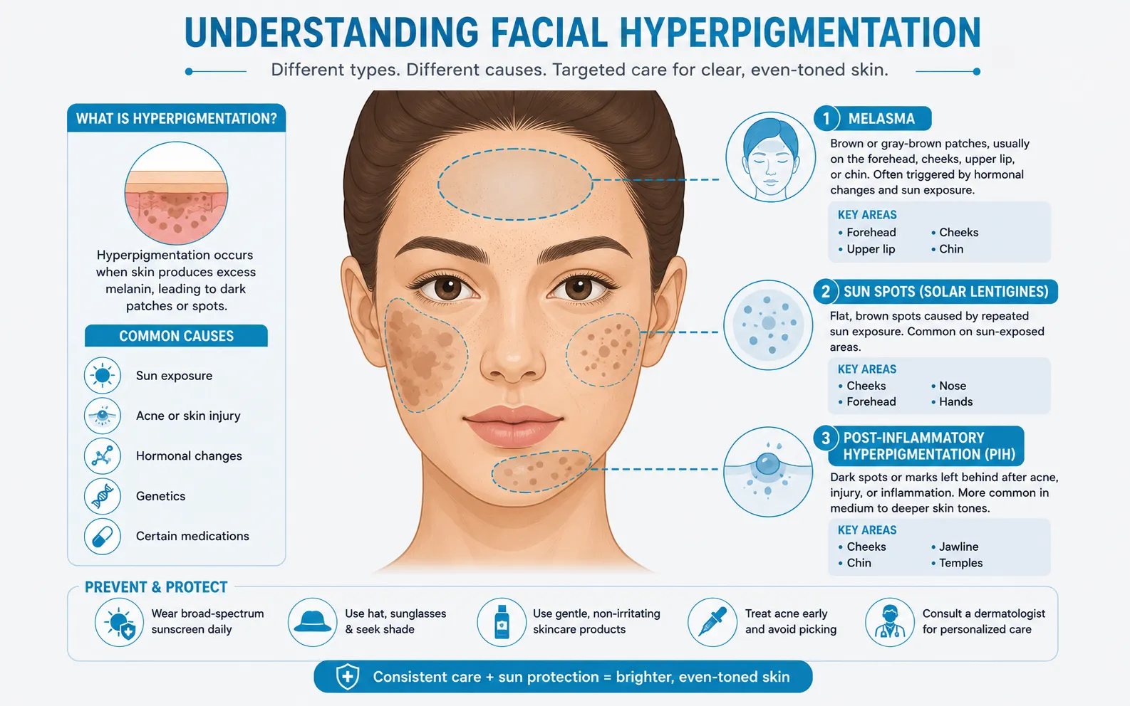 understanding facial hyperpigmentation 