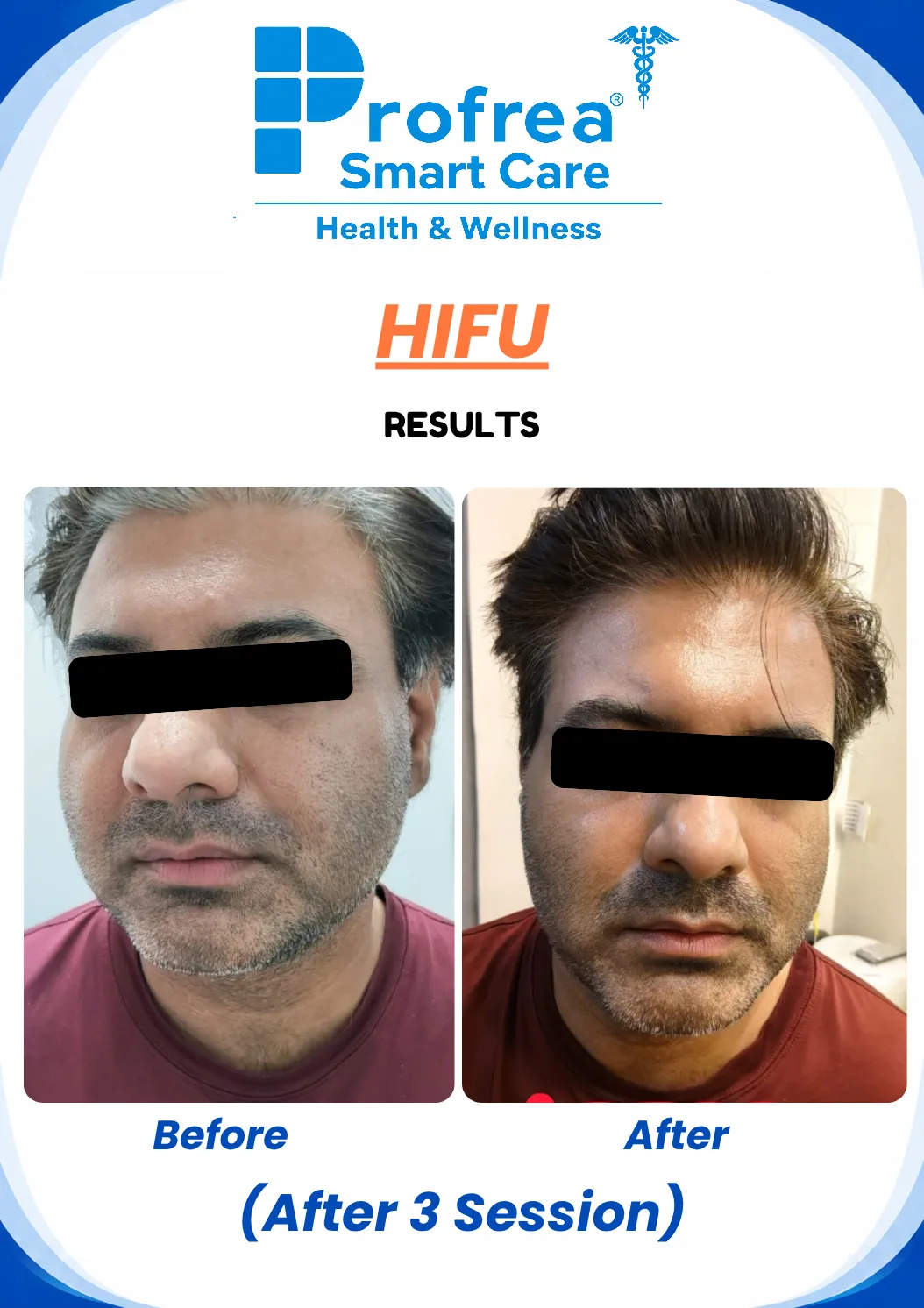 before and after image