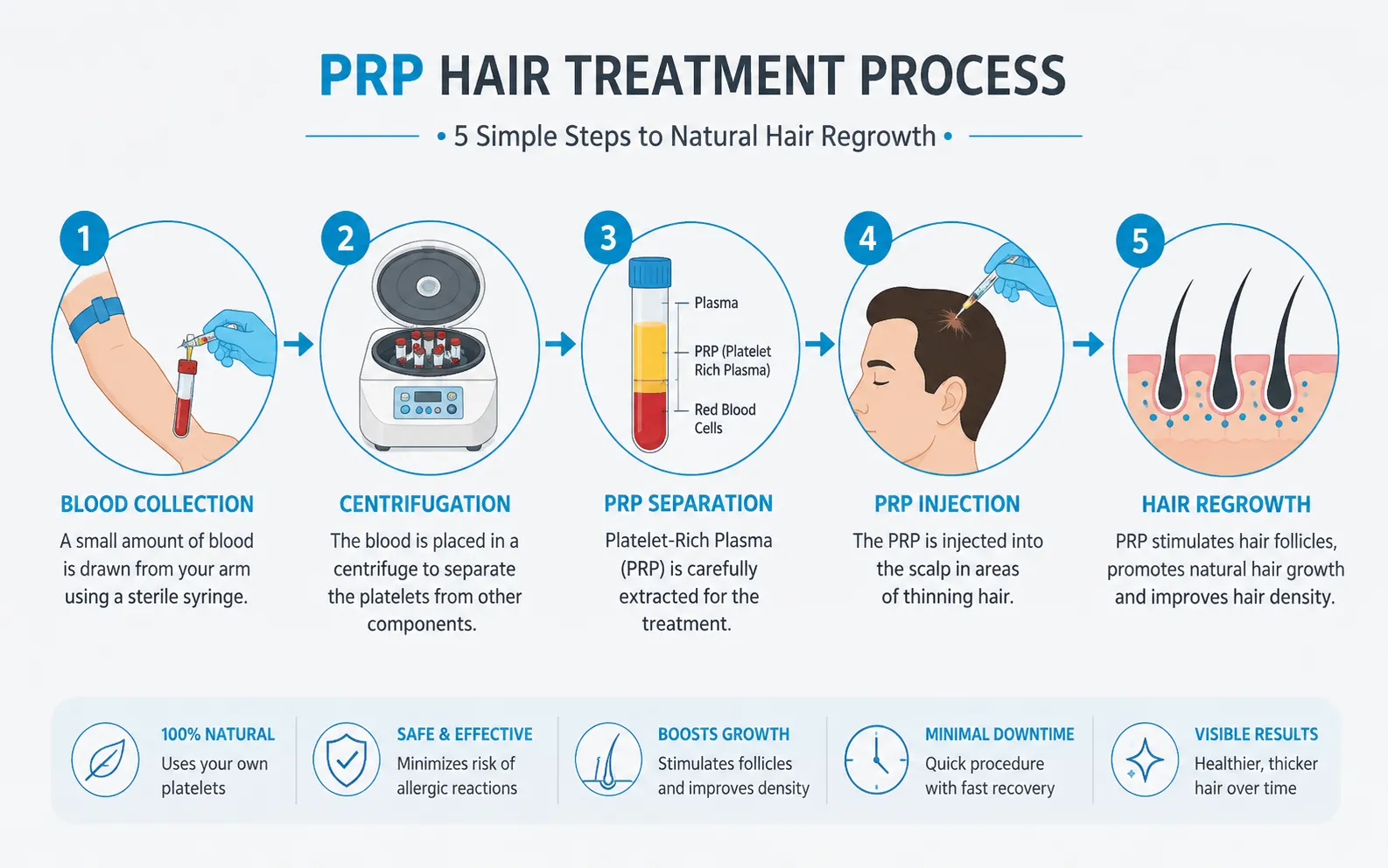 PRP hair treatment process