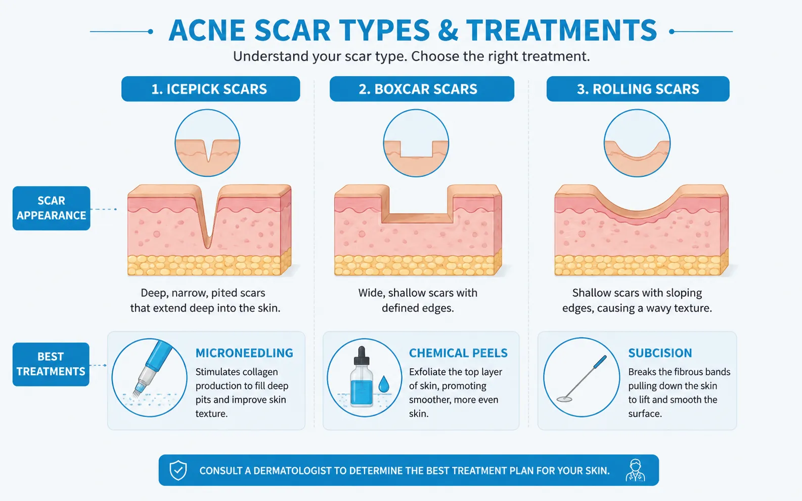acne scar treatment