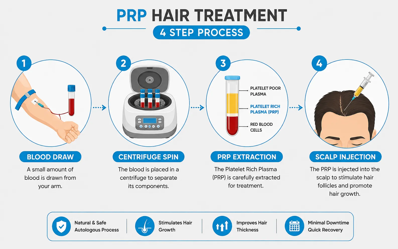 prp hair treatment
